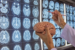 neurocirugia
